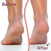 CART🛒أنا electric-feet-callus-removers