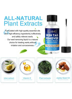 Skin Tag Remover