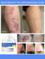 Skin Care Cream for Scars, Stretch Marks and Acne Skin, Scar Repair Cream for Scar Lightening and Skin Care Products for Skin Refreshment